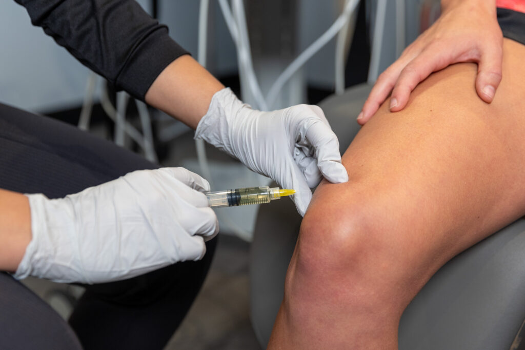 Close up of a woman in physical therapy at Balanced Flow Wellness receiving dry needling in Chicago.